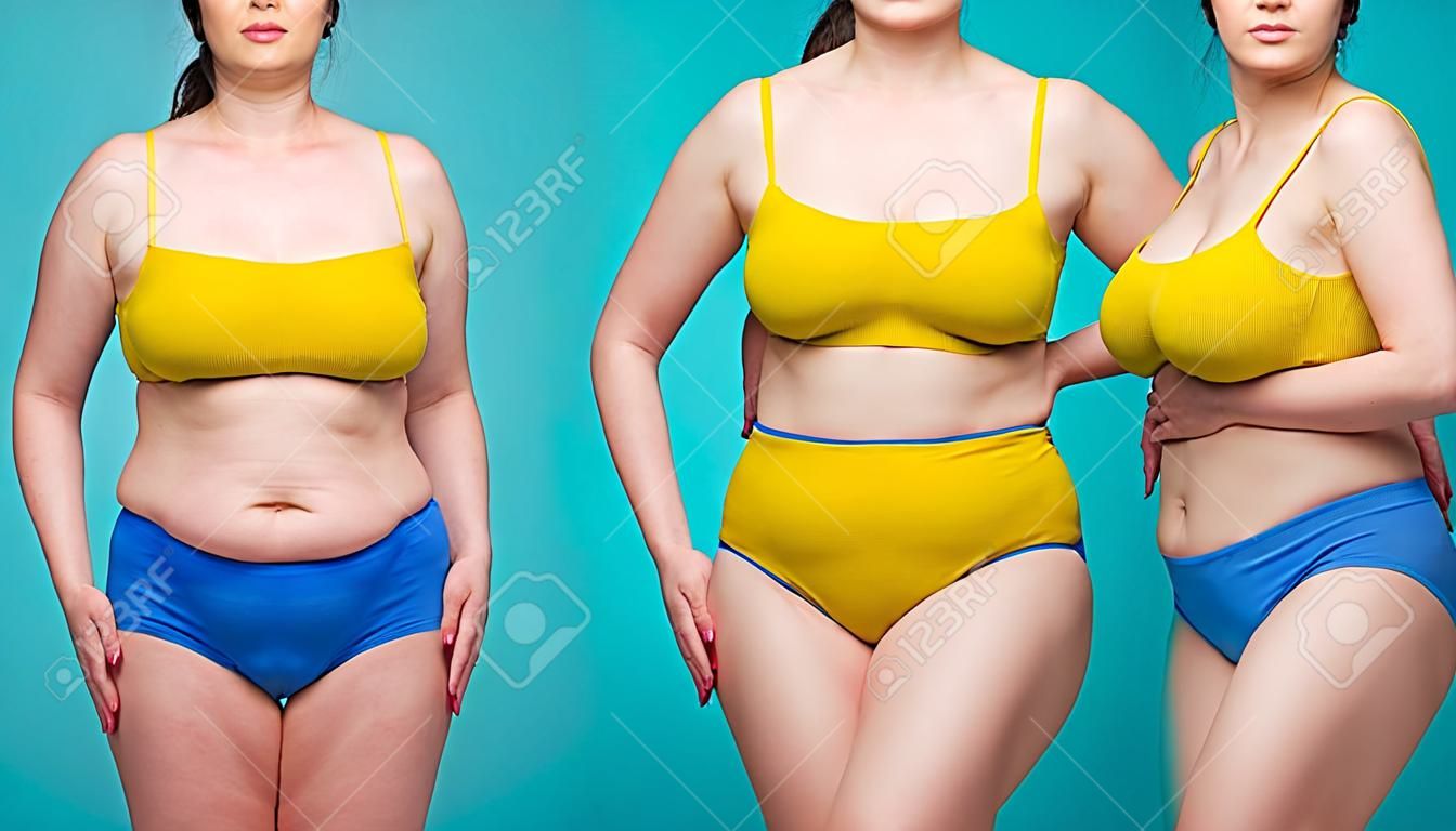Woman's body before and after weight loss on blue background, plastic surgery concept