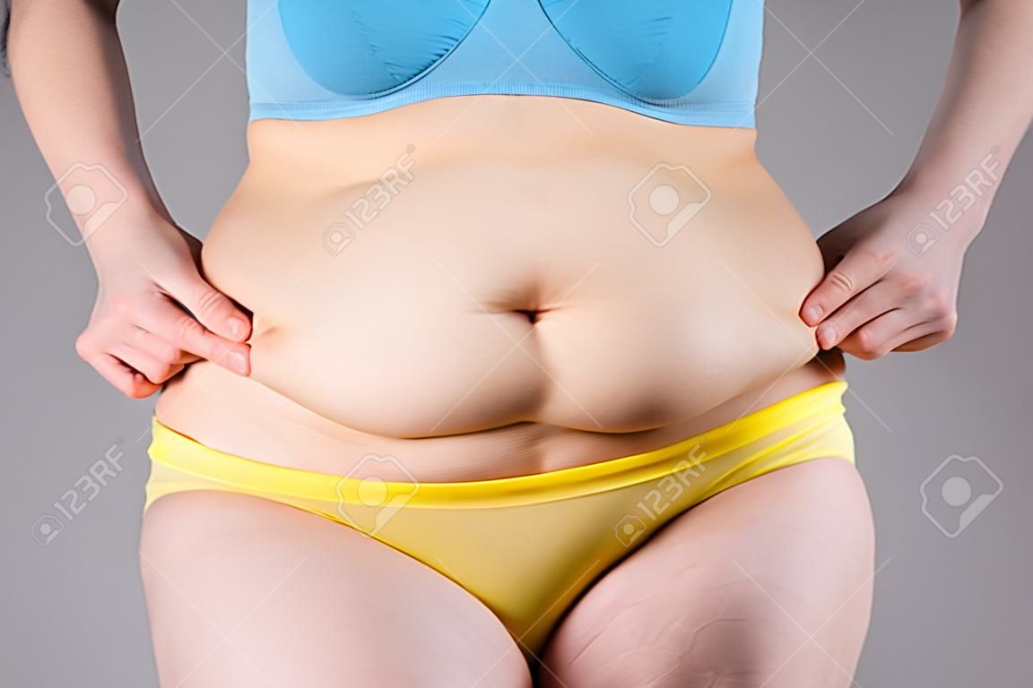 Tummy Tuck, slappe huid op een dikke buik, plastische chirurgie concept op grijze achtergrond