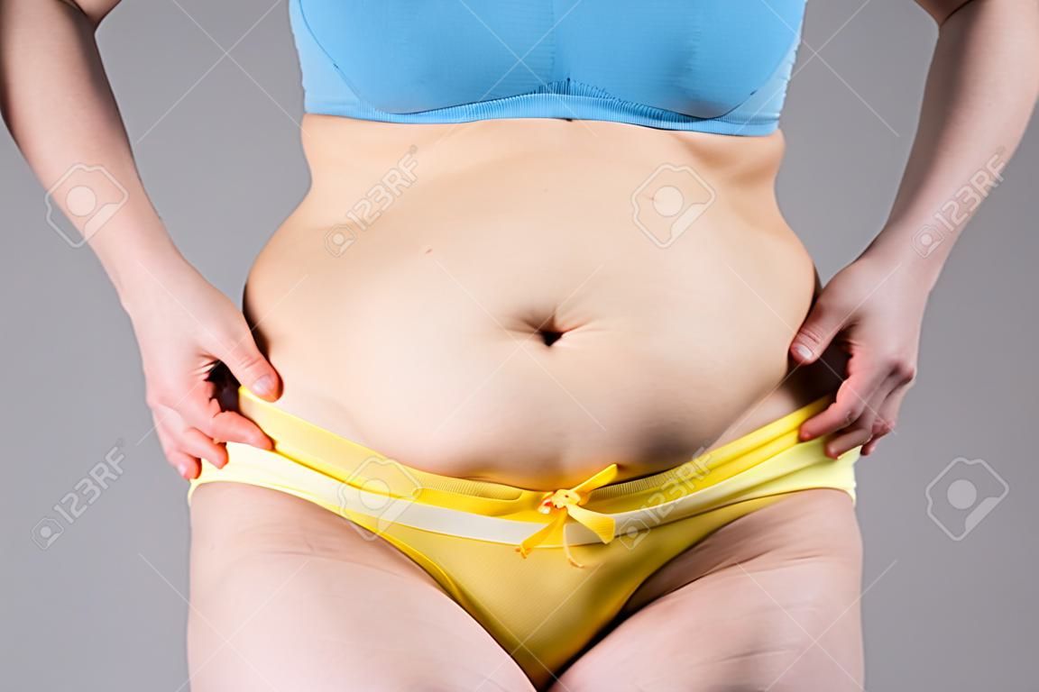Tummy Tuck, slappe huid op een dikke buik, plastische chirurgie concept op grijze achtergrond