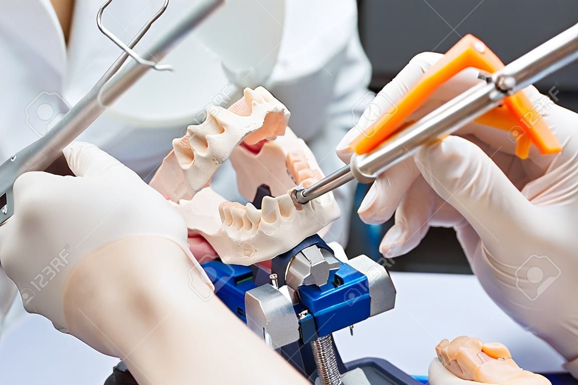 Un odontotecnico-dentista che lavora con le protesi in un laboratorio con la cera su un modello della mascella in articolatore