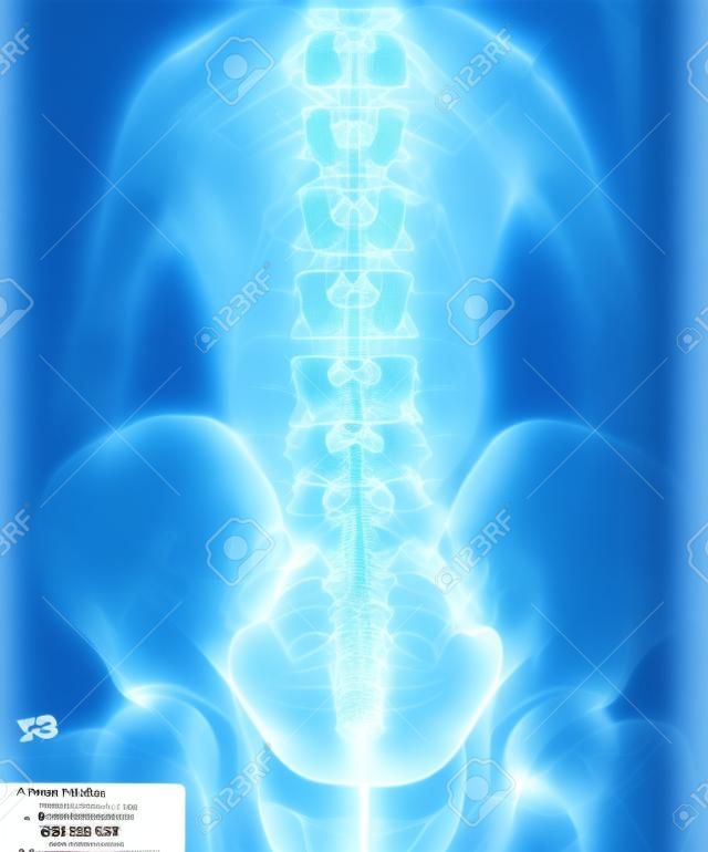 Película para rayos X columna vertebral LS espectáculo AP Antero-posterior humana normal