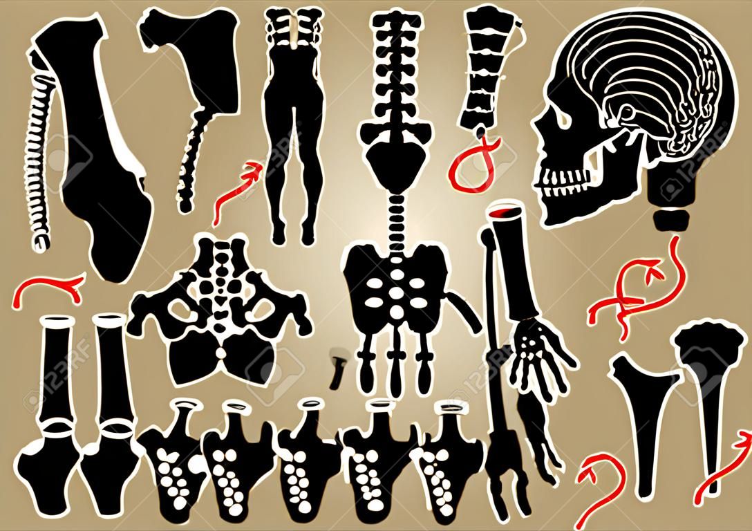 整形外科 （プレートとネジによって内部固定） のコレクション （頭蓋骨、頭、首、脊椎、仙骨、腕、前腕、手、肘、肩、骨盤、大腿、股関節、膝、足、足)