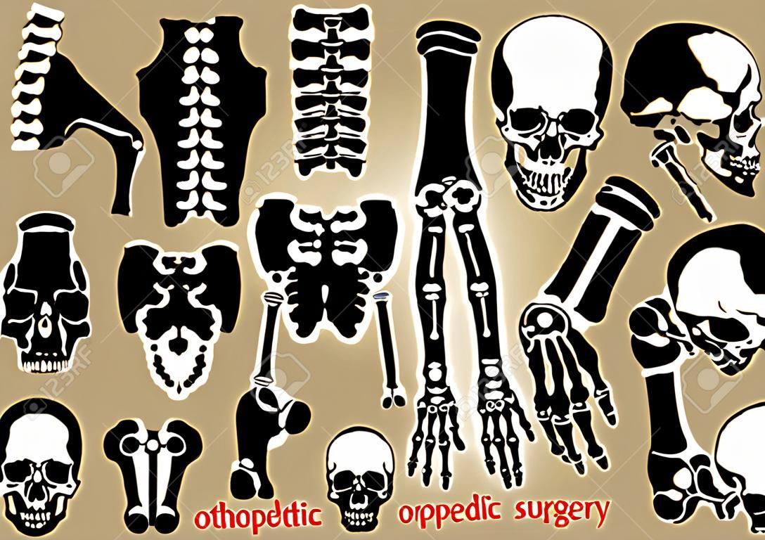 Raccolta di chirurgia ortopedica (fissazione interna da piastra e vite) (cranio, testa, collo, della colonna vertebrale, osso sacro, braccio, avambraccio, mano, gomito, spalla, bacino, coscia, anca, ginocchio, gamba, piede)