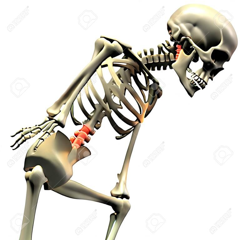 3D weergave van een menselijk skelet in een positie die pijn in de rug suggereert, gebogen met de handen die het lumbale gebied vasthouden