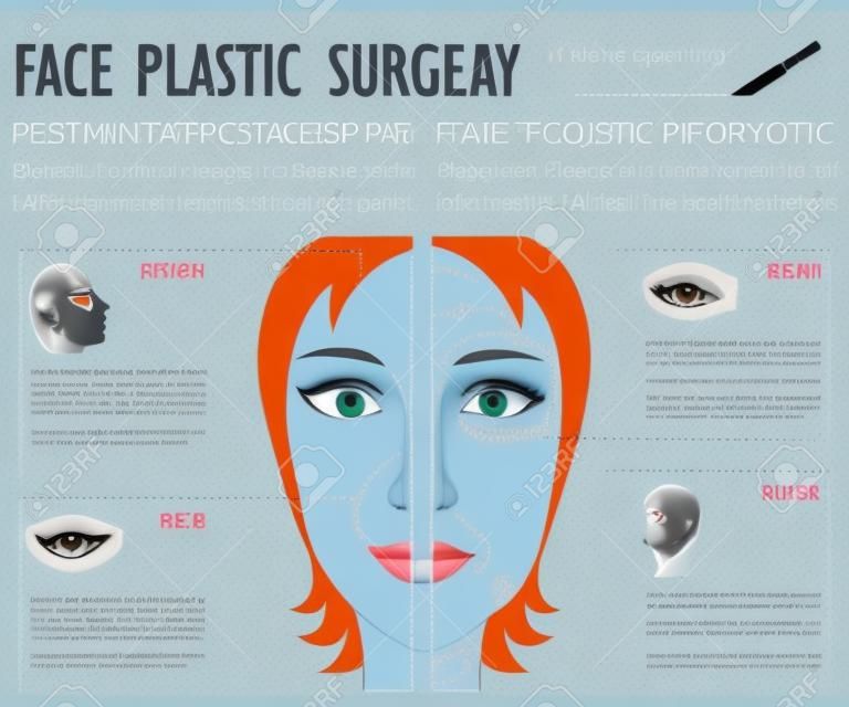 plastique cosmétique affiche de la chirurgie du visage avec des éléments infographiques. Rhinoplastie, lifting du visage, blépharoplastie, les yeux et la chirurgie des lèvres, la greffe de cheveux, implants de pommettes.