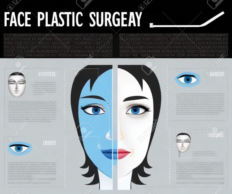 plastique cosmétique affiche de la chirurgie du visage avec des éléments infographiques. Rhinoplastie, lifting du visage, blépharoplastie, les yeux et la chirurgie des lèvres, la greffe de cheveux, implants de pommettes.