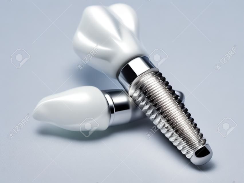 Implanty dentystyczne samodzielnie na białym tle