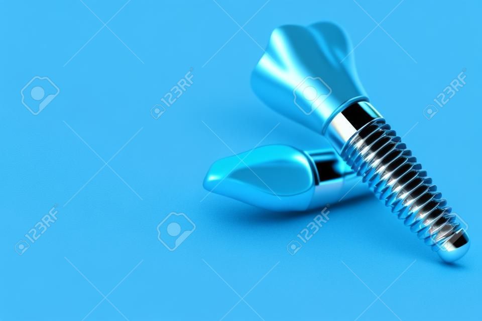 Implanty dentystyczne na białym tle na niebieskim tle. ilustracja 3d