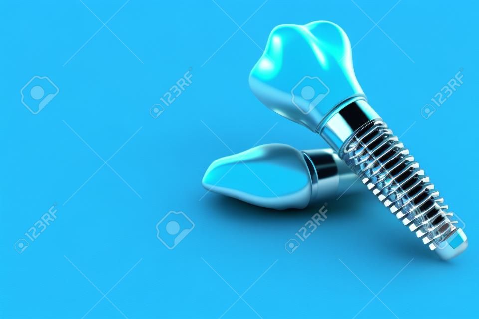 Implantes dentales aislados sobre fondo azul. Ilustración 3d