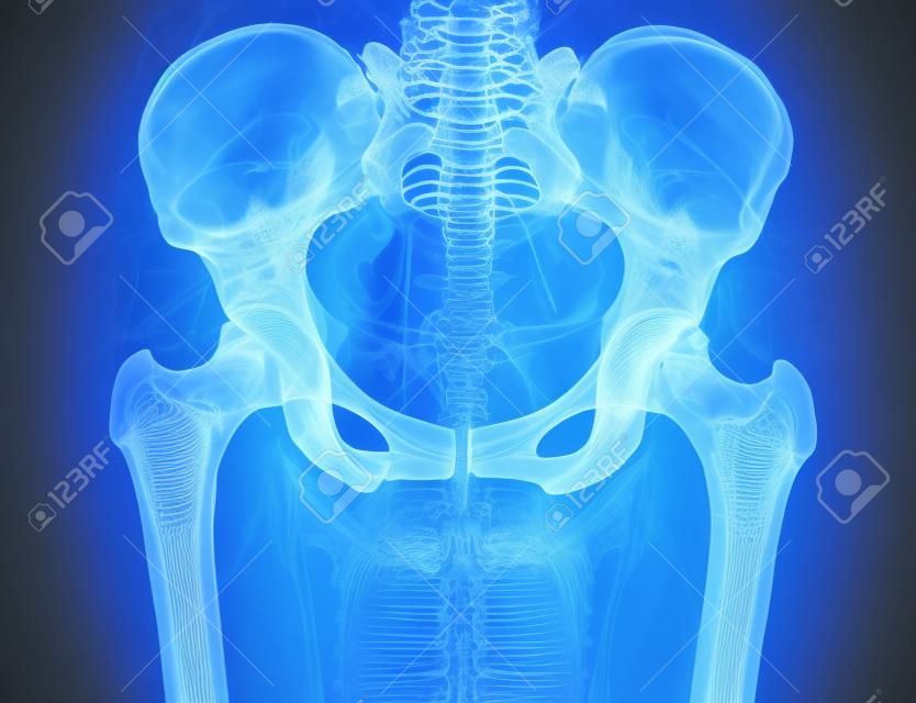 骨盤と女性の脊柱の x 線