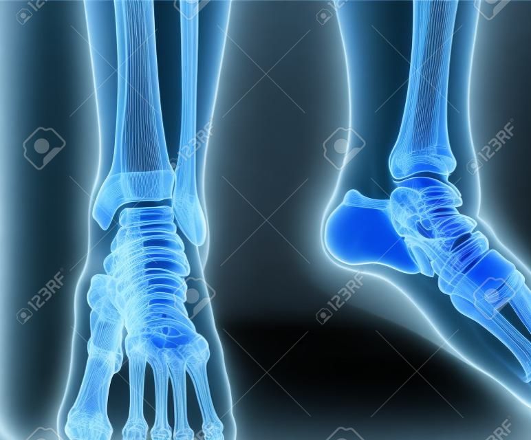 Close up x-ray of ankle
