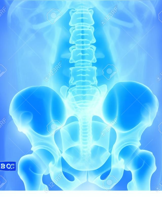 Pelvis ve omurga röntgen filmi