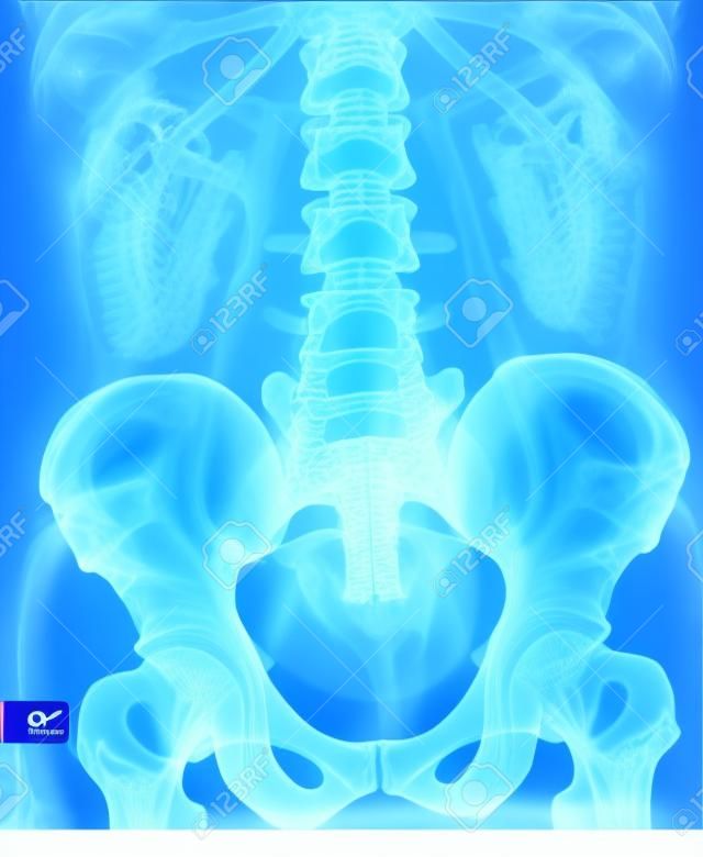 骨盤と脊柱の x 線
