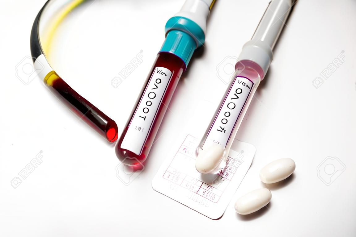 Test tube with blood sample for COVID-19 test experiment to detect virus in blood on white background, Developers of potential medicines and vaccines against COVID-19