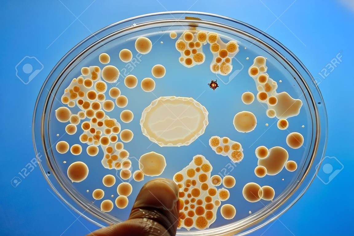 Colony of bacteria in culture medium plate, Microbiology.
