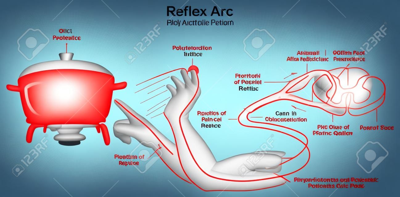 Diagrama de infográfico de arco reflexo com exemplo de reflexo polissináptico mão humana tocando receptores de dor de objeto quente e direção de impulso para educação em ciências médicas