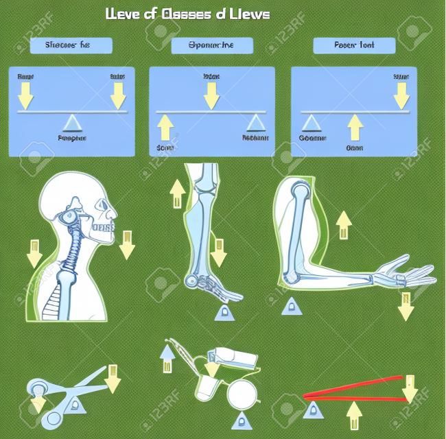 Diagramme infographique des classes de Lever montrant les pièces et les types, y compris la charge de pivot et l'effort avec des exemples d'articulations du corps humain os et muscles vie quotidienne pour l'enseignement des sciences physiques