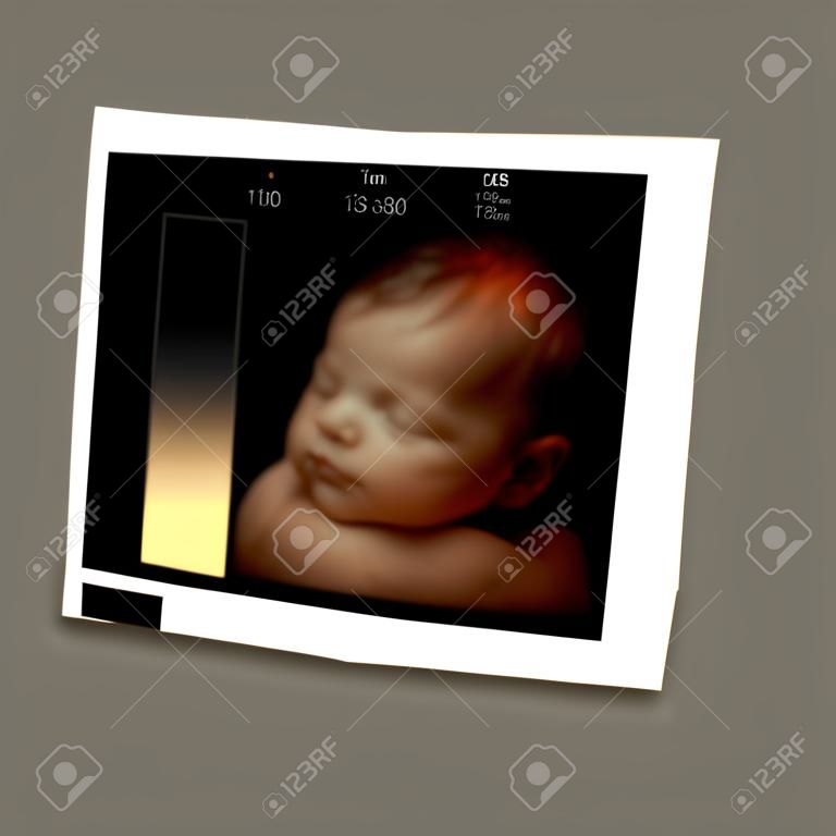 Bild des neugeborenen Baby wie 3D-Ultraschall von Baby in der Mutter Schoß