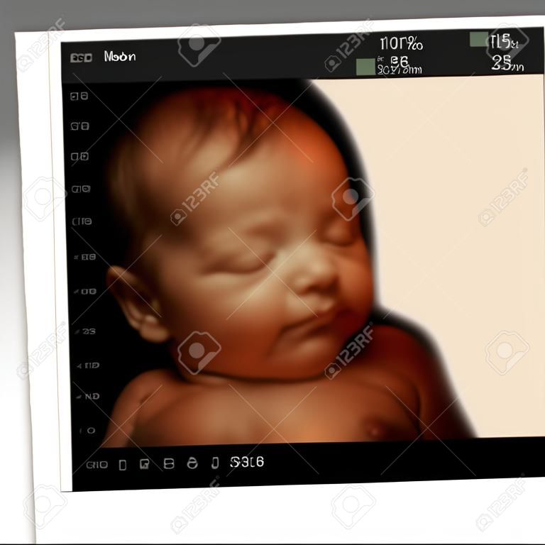 Изображение новорожденного как 3D УЗИ ребенка в утробе матери с