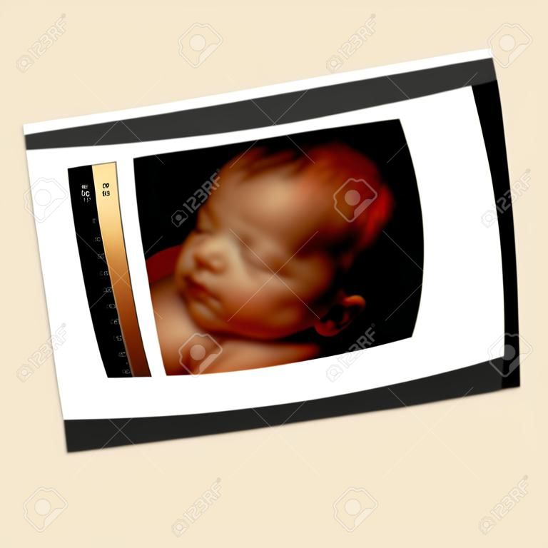 母の子宮に赤ちゃんの 3 D 超音波のような生まれたての赤ん坊のイメージ