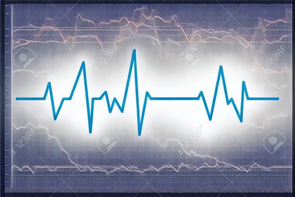 心線。矢量心電圖健康心跳脈搏。