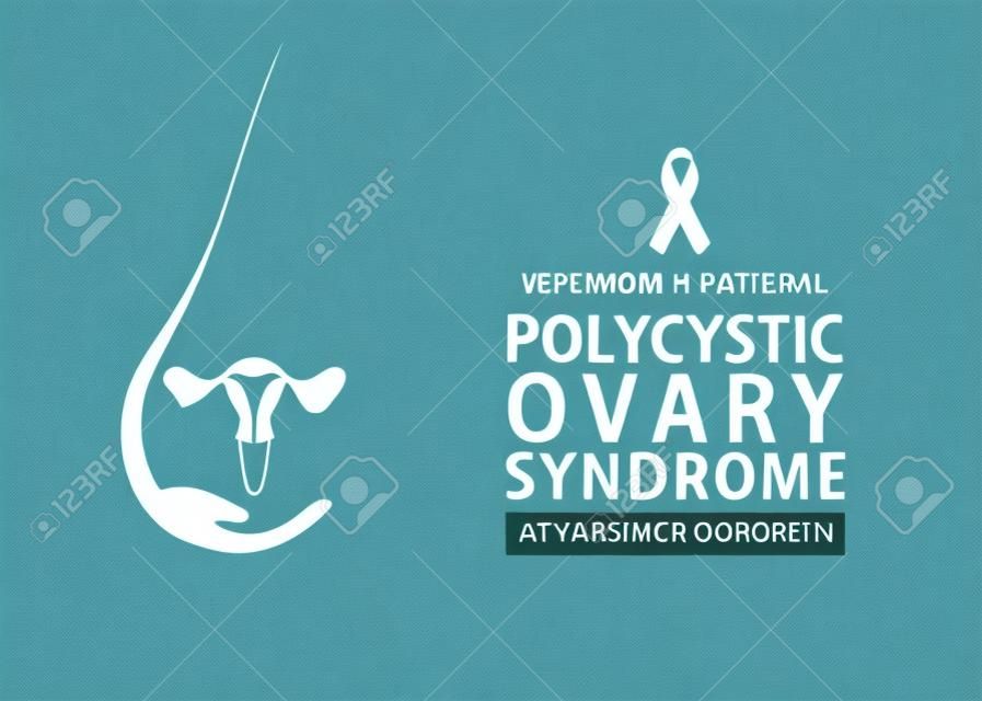 illustration vectorielle de la conception de l'affiche du mois de sensibilisation au syndrome des ovaires polykystiques.