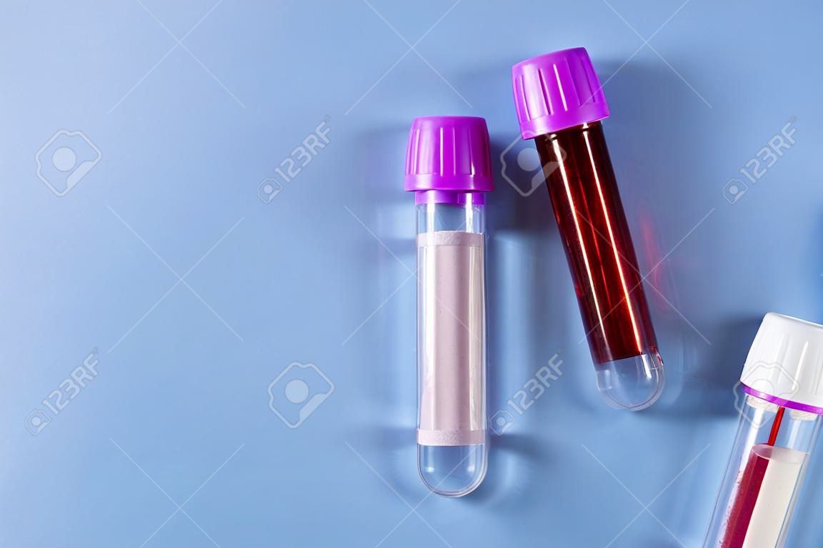 Three sample tubes with purple lids, one containing blood, on blue background with copy space. Blood health diagnostics, analysis and blood donation.