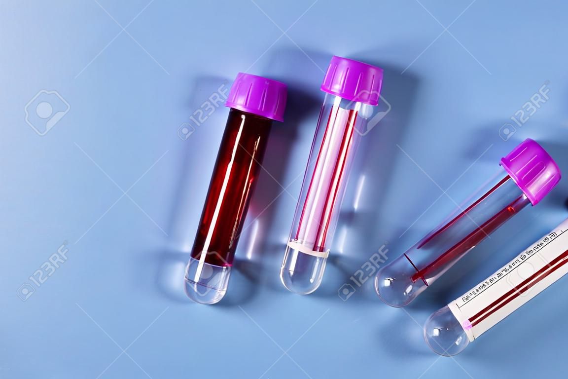 Three sample tubes with purple lids, one containing blood, on blue background with copy space. Blood health diagnostics, analysis and blood donation.
