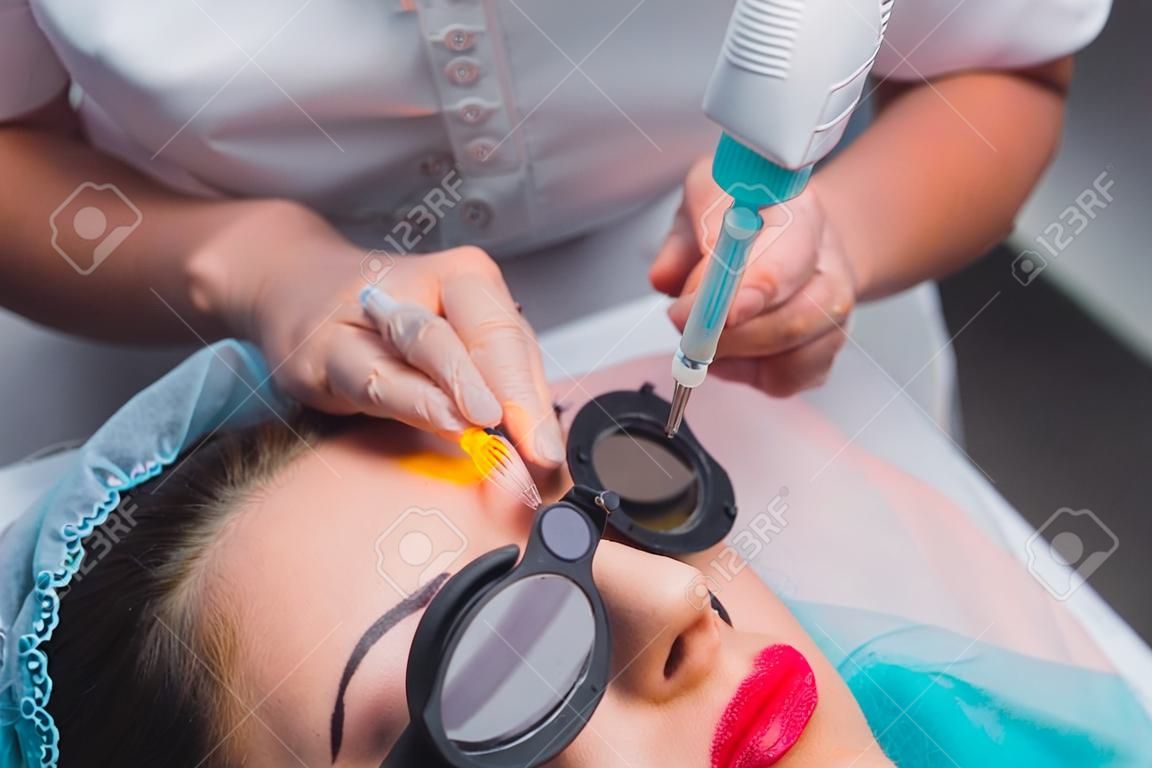 Eliminación láser de un maquillaje permanente en una cara. Mujer joven de primer plano que recibe la corrección de un tatuaje en el procedimiento de cejas. Corrección de imperfecciones naturales en un rostro.