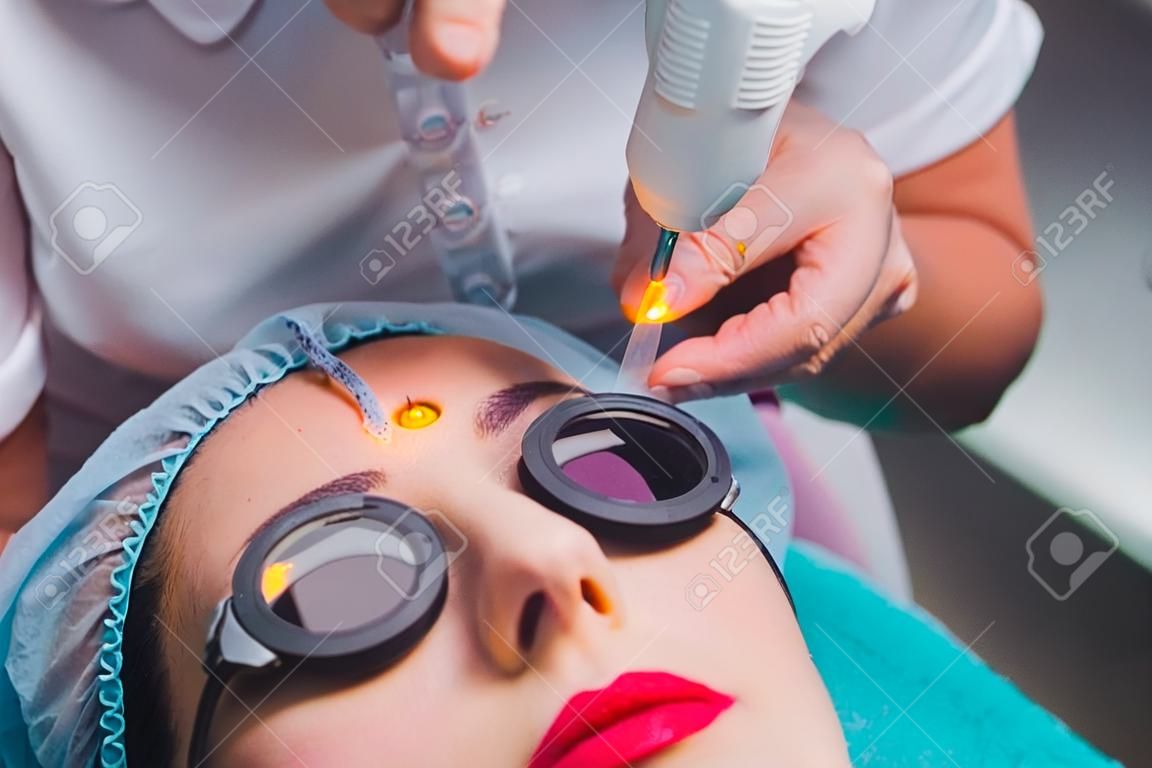 Eliminación láser de un maquillaje permanente en una cara. Mujer joven de primer plano que recibe la corrección de un tatuaje en el procedimiento de cejas. Corrección de imperfecciones naturales en un rostro.