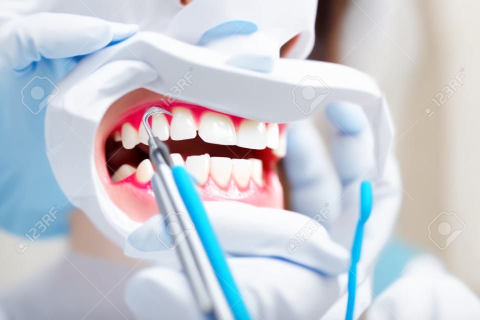 Portrait en gros plan d'une patiente visitant un dentiste pour le blanchiment des dents en clinique, procédure de blanchiment des dents.
