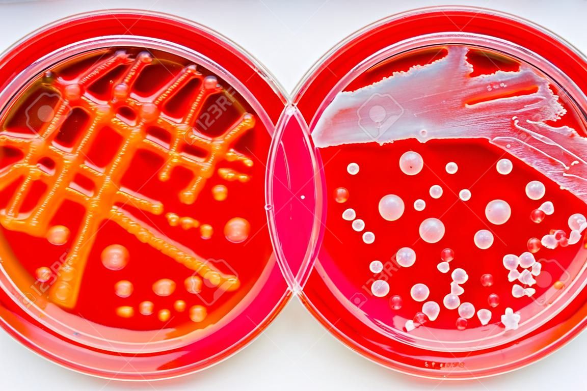 比較βween黄色ブドウ球菌とレンサ球菌の膿虫:血液寒天に対するグラム陽性球菌、βhemolys、α血中出血症。