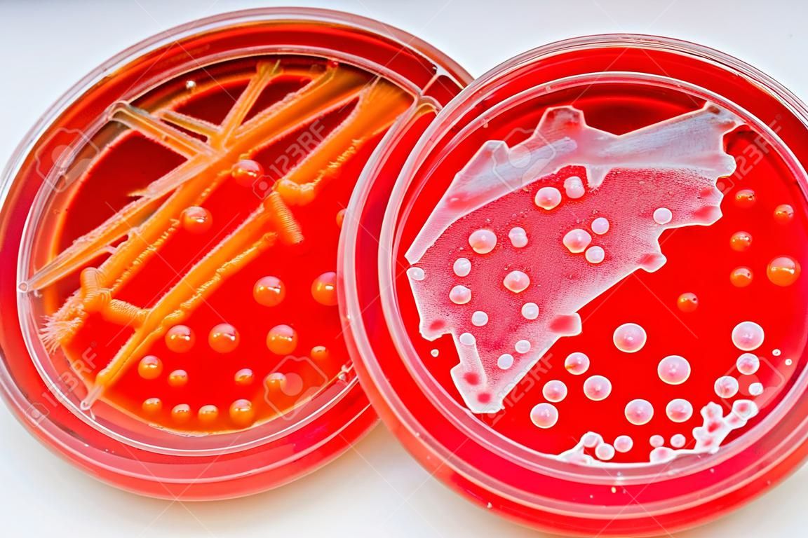 황색 포도상 구균과 연쇄상 구균 (Streptococcus pyogenes)의 비교
