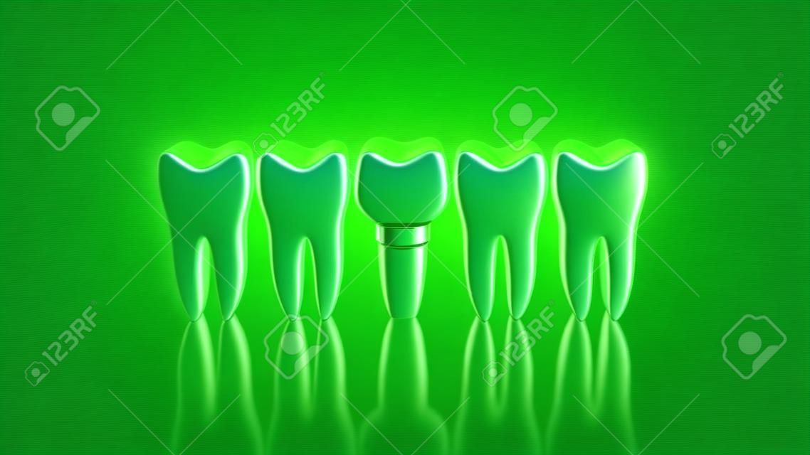 Denti e impianto dentale isolati su fondo verde. Illustrazione 3D