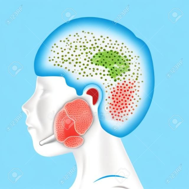 Person and salivary glands, parotid, submandibular and sublingual glands. Medical vector illustration.