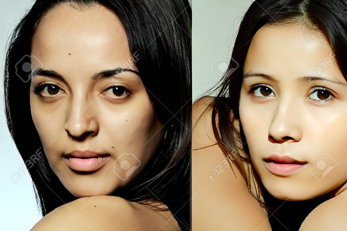Sağlık, insanlar, gençler ve güzellik konsepti - Kozmetik işlem öncesi ve sonrası. Genç güzel kadın portresi. Kozmetik veya plastik prosedür öncesi ve sonrası anti-age tedavisi, tedavi