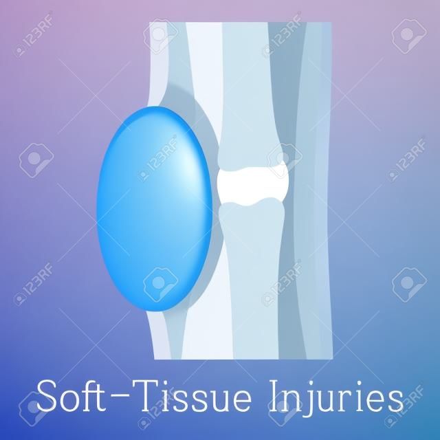 Soft tissue injury icon, cartoon style