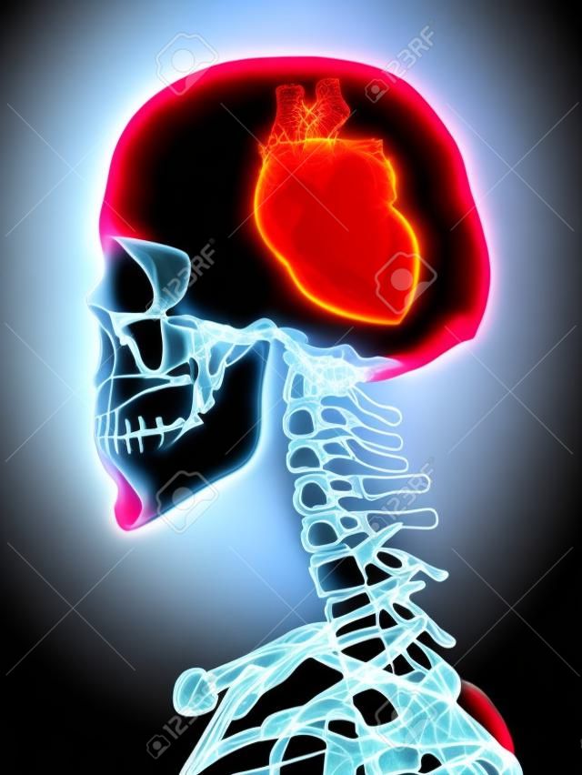 Xray of skull with heart instead of brain 