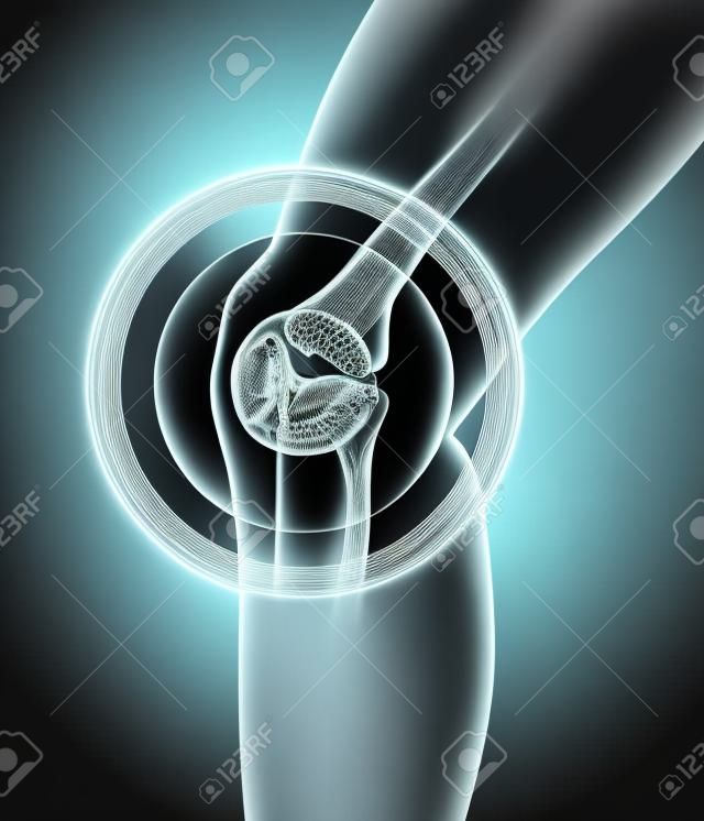 Knee painful - skeleton x-ray, 3D Illustration medical concept.