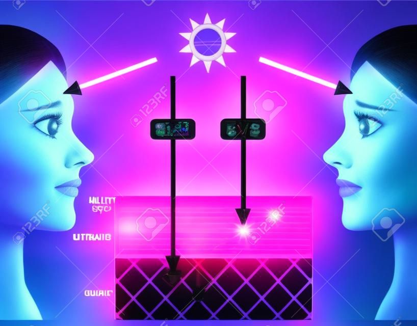 ultraibolya sugárzás