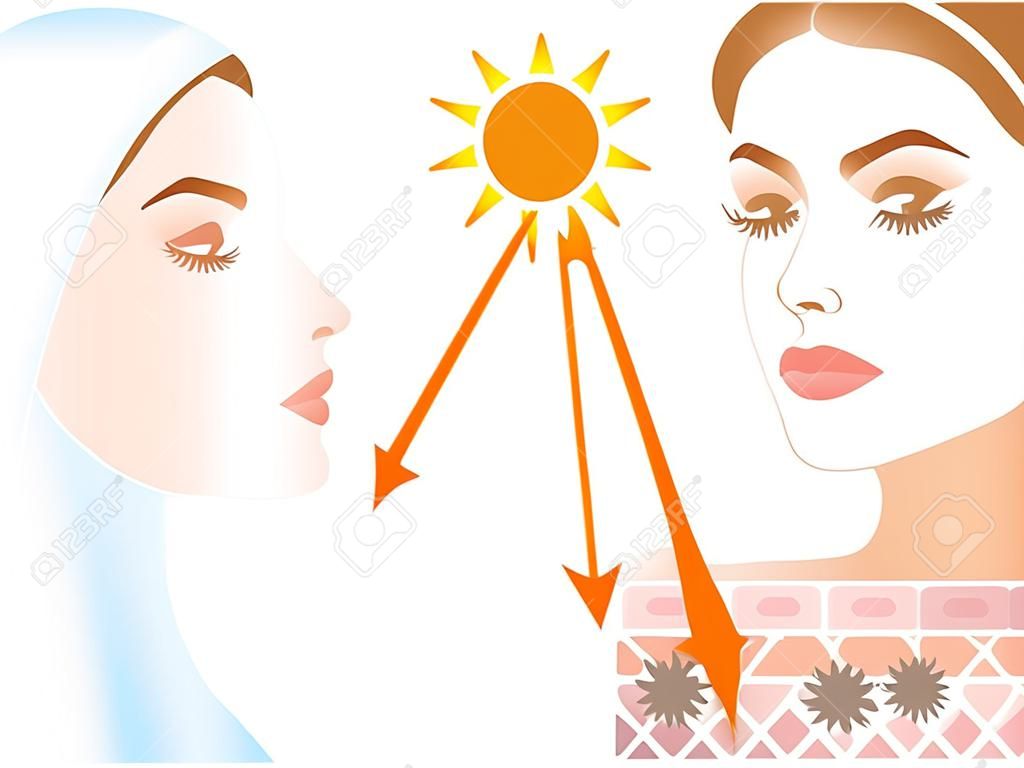 young woman applying sunscreen to her face protects her skin from uv rays and the other woman without wearing sunscreen damages her skin. skin diagram showing effects of sunscreen