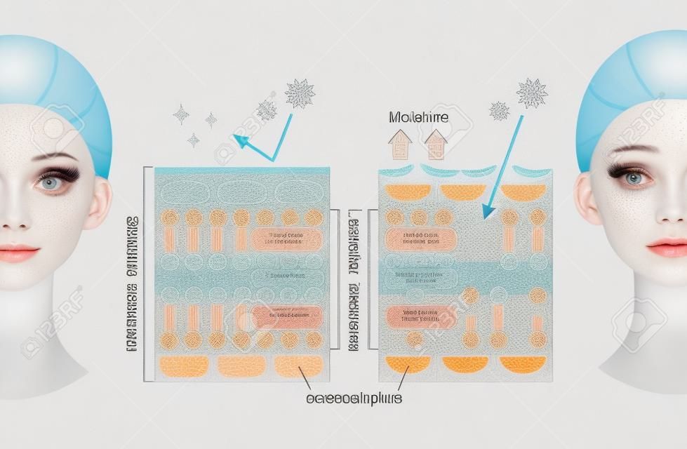 healthy skin and dry skin diagram with woman face. stratum corneum, the most superficial layer of the epidermis has a lamellar structure composed of layers of lipids and mo isture