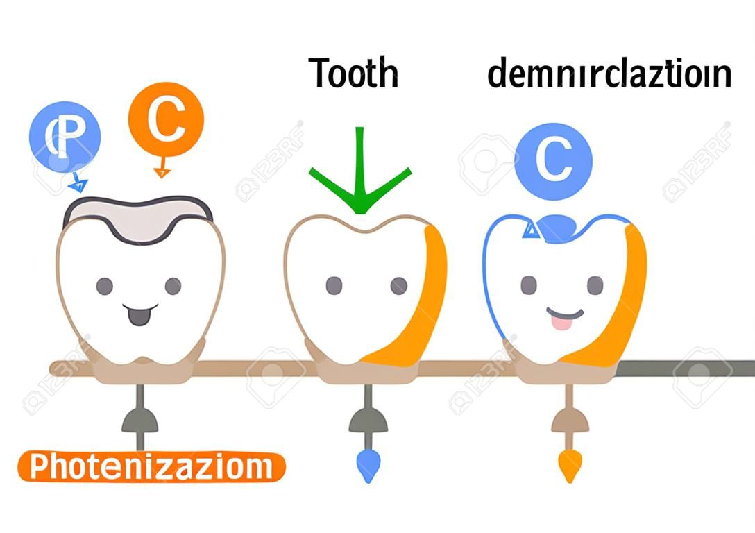 cute cartoon tooth. demineralization is caused by acids from bacteria. remineralization is the repair process. Healthy dental care.